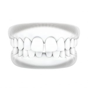 Smile Better with Invisalign Lite by T32 Dental | Singapore Dental Clinic 22